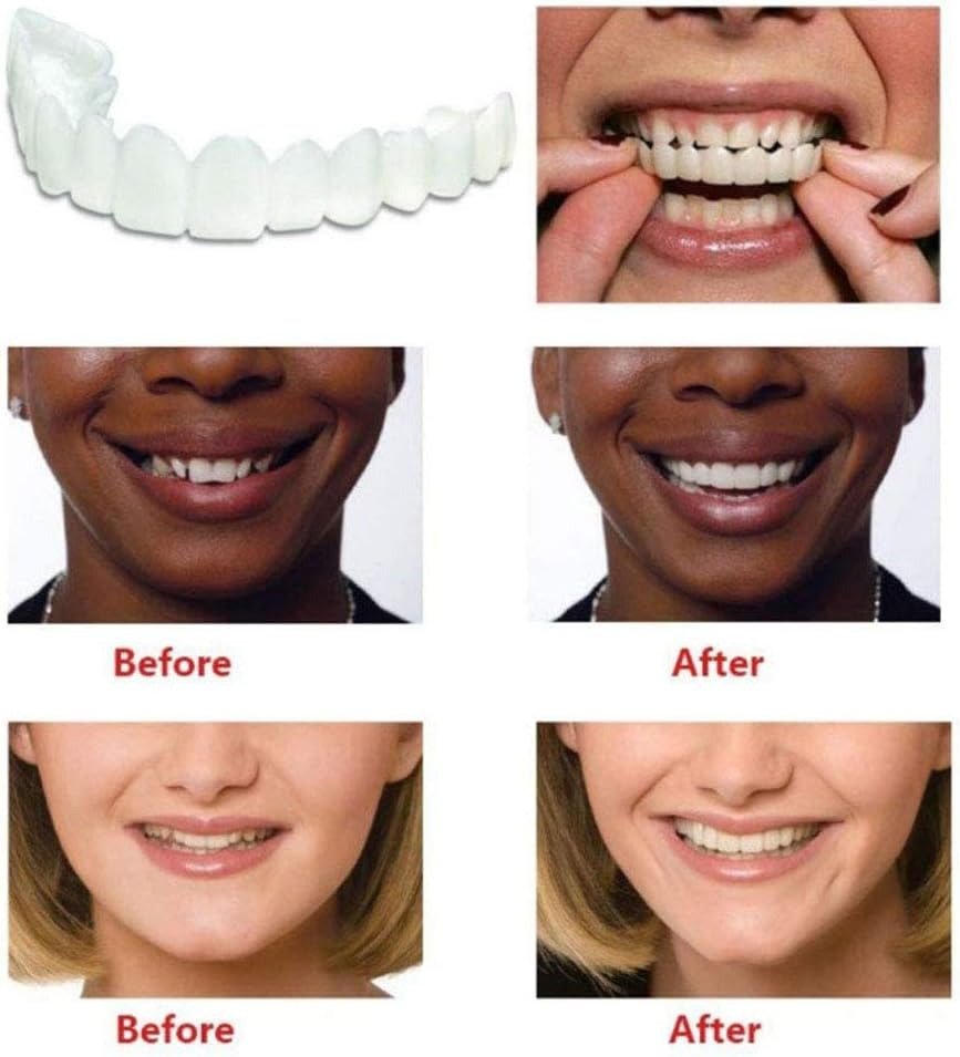 Comfort Fit Flexible Teeth
